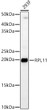 Western blot analysis of 293F, using RPL11 rabbit polyclonal antibody (STJ28490) at 1:1000 dilution. Secondary antibody: HRP Goat Anti-rabbit IgG (H+L) (STJS000856) at 1:10000 dilution. Lysates/proteins: 25 Mu g per lane. Blocking buffer: 3% non-fat dry milk in TBST. Detection: ECL Basic Kit. Exposure time: 90s.