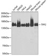 Western blot analysis of extracts of various cell lines, using TPP2 antibody (STJ28504) at 1:1000 dilution. Secondary antibody: HRP Goat Anti-Rabbit IgG (H+L) (STJS000856) at 1:10000 dilution. Lysates/proteins: 25 Mu g per lane. Blocking buffer: 3% nonfat dry milk in TBST. Detection: ECL Basic Kit. Exposure time: 30s.
