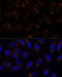 Immunofluorescence analysis of U-2 OS cells using RAMP1 antibody (STJ28530) at dilution of 1:100. Blue: DAPI for nuclear staining.