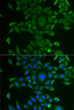Immunofluorescence analysis of U2OS cells using CCBL1 antibody (STJ28625). Blue: DAPI for nuclear staining.