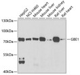 Western blot analysis of extracts of various cell lines, using GBE1 antibody (STJ28682) at 1:1000 dilution. Secondary antibody: HRP Goat Anti-Rabbit IgG (H+L) (STJS000856) at 1:10000 dilution. Lysates/proteins: 25 Mu g per lane. Blocking buffer: 3% nonfat dry milk in TBST. Detection: ECL Basic Kit. Exposure time: 90s.