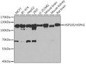 Western blot analysis of extracts of various cell lines, using HSP105/HSP105/HSPH1 antibody (STJ28705) at 1:1000 dilution. Secondary antibody: HRP Goat Anti-Rabbit IgG (H+L) (STJS000856) at 1:10000 dilution. Lysates/proteins: 25 Mu g per lane. Blocking buffer: 3% nonfat dry milk in TBST. Detection: ECL Basic Kit. Exposure time: 1s.