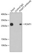 Immunoprecipitation analysis of 200 Mu g extracts of HepG2 cells using 1 Mu g PCMT1 antibody (STJ28767). Western blot was performed from the immunoprecipitate using PCMT1 antibody (STJ28767) at a dilution of 1:1000.