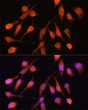 Immunofluorescence analysis of HeLa cells using PPM1A Rabbit polyclonal antibody (STJ28782) at dilution of 1:100 (40x lens). Blue: DAPI for nuclear staining.