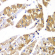 Immunohistochemistry analysis of paraffin-embedded mouse heart using PPP1R12A Antibody (STJ28783) at dilution of 1:100 (40x lens). Perform microwave antigen retrieval with 10 mM PBS buffer pH 7. 2 before commencing with immunohistochemistry staining protocol.