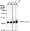 Western blot analysis of various lysates, using PP2A Catalytic Alpha antibody (STJ28785) at 1:2000 dilution. Secondary antibody: HRP Goat Anti-rabbit IgG (H+L) (STJS000856) at 1:10000 dilution. Lysates/proteins: 25 Mu g per lane. Blocking buffer: 3% non-fat dry milk in TBST. Detection: ECL Basic Kit. Exposure time: 10s.
