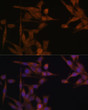 Immunofluorescence analysis of HeLa cells using PP2A Catalytic Alpha antibody (STJ28785) at dilution of 1:100. Blue: DAPI for nuclear staining.