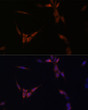 Immunofluorescence analysis of NIH/3T3 cells using PP2A Catalytic Alpha antibody (STJ28785) at dilution of 1:100. Blue: DAPI for nuclear staining.