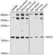 Western blot analysis of various lysates using RPLP1 Rabbit polyclonal antibody (STJ28808) at 1:1000 dilution. Secondary antibody: HRP Goat Anti-Rabbit IgG (H+L) (STJS000856) at 1:10000 dilution. Lysates/proteins: 25 Mu g per lane. Blocking buffer: 3% nonfat dry milk in TBST. Detection: ECL Basic Kit. Exposure time: 60s.