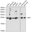 Western blot analysis of extracts of various cell lines, using RPS7 antibody (STJ28814) at 1:1000 dilution. Secondary antibody: HRP Goat Anti-Rabbit IgG (H+L) (STJS000856) at 1:10000 dilution. Lysates/proteins: 25 Mu g per lane. Blocking buffer: 3% nonfat dry milk in TBST. Detection: ECL Basic Kit. Exposure time: 90s.