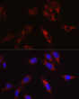 Immunofluorescence analysis of U2OS cells using SECISBP2 Rabbit polyclonal antibody (STJ28819) at dilution of 1:50 (40x lens). Blue: DAPI for nuclear staining.