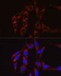 Immunofluorescence analysis of NIH/3T3 cells using SECISBP2 Rabbit polyclonal antibody (STJ28819) at dilution of 1:50 (40x lens). Blue: DAPI for nuclear staining.