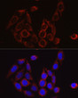 Immunofluorescence analysis of HeLa cells using SECISBP2 Rabbit polyclonal antibody (STJ28819) at dilution of 1:50 (40x lens). Blue: DAPI for nuclear staining.