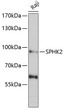Western blot analysis of extracts of Raji cells, using SPHK2 antibody (STJ28831) at 1:1000 dilution. Secondary antibody: HRP Goat Anti-Rabbit IgG (H+L) (STJS000856) at 1:10000 dilution. Lysates/proteins: 25 Mu g per lane. Blocking buffer: 3% nonfat dry milk in TBST. Detection: ECL Basic Kit. Exposure time: 90s.