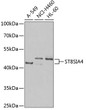 Western blot analysis of extracts of various cell lines, using ST8SIA4 Antibody (STJ28837) at 1:1000 dilution. _Secondary antibody: HRP Goat Anti-Rabbit IgG (H+L) (STJS000856) at 1:10000 dilution. _Lysates/proteins: 25 Mu g per lane. _Blocking buffer: 3% nonfat dry milk in TBST. _Detection: ECL Enhanced Kit. _Exposure time: 90s.
