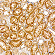 Immunohistochemistry analysis of TAT in paraffin-embedded rat kidney tissue using TAT Rabbit polyclonal antibody (STJ28847) at a dilution of 1:500 (40x lens). High pressure antigen retrieval was performed with 0. 01 M citrate buffer (pH 6. 0) prior to immunohistochemistry staining.