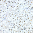 Immunohistochemistry analysis of paraffin-embedded human liver using TEAD1 rabbit polyclonal antibody (STJ28851) at dilution of 1:50 (40x lens). Perform high pressure antigen retrieval with 10 mM citrate buffer pH 6. 0 before commencing with immunohistochemistry staining protocol.