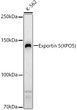 Western blot analysis of various lysates, using Exportin 5 (XPO5) rabbit polyclonal antibody (STJ28873) at 1:10000 dilution. Secondary antibody: HRP Goat Anti-rabbit IgG (H+L) (STJS000856) at 1:10000 dilution. Lysates/proteins: 25 Mu g per lane. Blocking buffer: 3% non-fat dry milk in TBST. Detection: ECL Basic Kit. Exposure time: 90s.