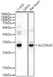 Western blot analysis of extracts of various cell lines, using SLC25A20 antibody (STJ28960) at 1:500 dilution. Secondary antibody: HRP Goat Anti-rabbit IgG (H+L) (STJS000856) at 1:10000 dilution. Lysates/proteins: 25 Mu g per lane. Blocking buffer: 3% non-fat dry milk in TBST. Detection: ECL Basic Kit. Exposure time: 60s.