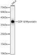 Western blot analysis of HeLa, using GDF-8/Myostatin Rabbit polyclonal antibody (STJ28993) at 1:500 dilution. Secondary antibody: HRP Goat Anti-Rabbit IgG (H+L) (STJS000856) at 1:10000 dilution. Lysates/proteins: 25ug per lane. Blocking buffer: 3% nonfat dry milk in TBST. Detection: ECL Basic Kit. Exposure time: 60s.