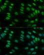 Immunofluorescence analysis of C6 cells using hnRNPM antibody (STJ29017) at dilution of 1:100. Blue: DAPI for nuclear staining.