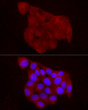 Immunofluorescence analysis of HeLa cells using RARRES2 Rabbit polyclonal antibody (STJ29043) at dilution of 1:50 (40x lens). Blue: DAPI for nuclear staining.
