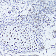 Immunohistochemistry analysis of paraffin-embedded mouse embryos using SOX5 rabbit polyclonal antibody (STJ29065) at dilution of 1:50 (40x lens). Perform high pressure antigen retrieval with 10 mM citrate buffer pH 6. 0 before commencing with immunohistochemistry staining protocol.