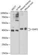 Western blot analysis of extracts of various cell lines, using DAP3 Antibody (STJ29083) at 1:1000 dilution. Secondary antibody: HRP Goat Anti-Rabbit IgG (H+L) (STJS000856) at 1:10000 dilution. Lysates/proteins: 25 Mu g per lane. Blocking buffer: 3% nonfat dry milk in TBST. Detection: ECL Basic Kit. Exposure time: 90s.