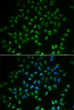Immunofluorescence analysis of A549 cells using HAND2 antibody (STJ29124). Blue: DAPI for nuclear staining.