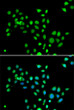 Immunofluorescence analysis of U2OS cells using [KO Validated] macroH2A. 1 Rabbit polyclonal antibody (STJ29125). Secondary antibody: Cy3 Goat Anti-Rabbit IgG (H+L) at 1:500 dilution. Blue: DAPI for nuclear staining.