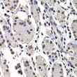 Immunohistochemistry analysis of macroH2A. 1 in paraffin-embedded human stomach using [KO Validated] macroH2A. 1 Rabbit polyclonal antibody (STJ29125) at dilution of 1:100 (40x lens). Perform microwave antigen retrieval with 10 mM PBS buffer pH 7. 2 before commencing with immunohistochemistry staining protocol.