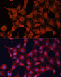 Immunofluorescence analysis of C6 cells using DNAJA2 antibody (STJ29139) at dilution of 1:100. Blue: DAPI for nuclear staining.
