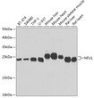 Western blot analysis of extracts of various cell lines, using NFU1 antibody (STJ29177) at 1:1000 dilution. Secondary antibody: HRP Goat Anti-Rabbit IgG (H+L) (STJS000856) at 1:10000 dilution. Lysates/proteins: 25 Mu g per lane. Blocking buffer: 3% nonfat dry milk in TBST. Detection: ECL Basic Kit. Exposure time: 30s.