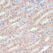 Immunohistochemistry analysis of NAA20 in paraffin-embedded rat kidney using NAA20 Rabbit polyclonal antibody (STJ29185) at dilution of 1:100 (40x lens). Perform microwave antigen retrieval with 10 mM PBS buffer pH 7. 2 before commencing with immunohistochemistry staining protocol.