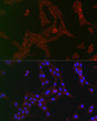 Immunofluorescence analysis of PC-12 cells using GCN2 Rabbit polyclonal antibody (STJ29235) at dilution of 1:100 (40x lens). Blue: DAPI for nuclear staining.