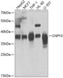 Western blot analysis of extracts of various cell lines, using CNPY3 antibody (STJ29256) at 1:1000 dilution. _Secondary antibody: HRP Goat Anti-rabbit IgG (H+L) (STJS000856) at 1:10000 dilution. _Lysates/proteins: 25 Mu g per lane. _Blocking buffer: 3% non-fat dry milk in TBST. _Detection: ECL Enhanced Kit. _Exposure time: 15s.