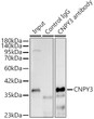Immunoprecipitation analysis of 300ug extracts of THP-1 cells using 3ug CNPY3 rabbit polyclonal antibody (STJ29256 1:40). Western blot was performed from the immunoprecipitate using CNPY3 rabbit polyclonal antibody (STJ29256) at a dilition of 1:500.