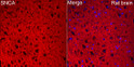 Immunofluorescence analysis of rat brain cells using Alpha-Synuclein Rabbit polyclonal antibody (STJ29295) at dilution of 1:100 (40x lens). Secondary antibody: Cy3 Goat Anti-Rabbit IgG (H+L) at 1:500 dilution. Blue: DAPI for nuclear staining.