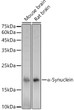 Western blot analysis of various lysates using Alpha-Synuclein Rabbit polyclonal antibody (STJ29295) at 1:1000 dilution. Secondary antibody:HRP Goat Anti-Rabbit IgG (H+L) (STJS000856) at 1:10000 dilution. Lysates/ proteins: 25 Mu g per lane. Blocking buffer: 3 % nonfat dry milk in TBST. Detection:ECL Basic Kit. Exposuretime: 1s.