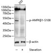 Western blot analysis of lysates from 293 cells, using Phospho-AMPK Beta 1-S108 Rabbit pAb (STJ29363) at 1:1000 dilution. <br/>Secondary antibody: HRP-conjugated Goat anti-Rabbit IgG (H+L) (STJS000856) at 1:10000 dilution. <br/>Lysates/proteins: 25 Mu g per lane. <br/>Blocking buffer: 3% BSA.