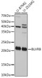 Western blot analysis of extracts of various cell lines, using BLVRB Rabbit polyclonal antibody (STJ29401) at 1:1000 dilution. Secondary antibody: HRP Goat Anti-Rabbit IgG (H+L) (STJS000856) at 1:10000 dilution. Lysates/proteins: 25 Mu g per lane. Blocking buffer: 3% nonfat dry milk in TBST. Detection: ECL Basic Kit. Exposure time: 30s.
