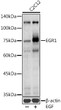 Western blot analysis of lysates from C2C12 cells, using EGR1 Rabbit pAb (STJ29407) at 1:1000 dilution. C2C12 cells were treated by EGF (100 ng/ml) at 37 °C for 30 minutes after serum-starvation overnight. <br/>Secondary antibody: HRP-conjugated Goat anti-Rabbit IgG (H+L) (STJS000856) at 1:10000 dilution. <br/>Lysates/proteins: 25 Mu g per lane. <br/>Blocking buffer: 3% nonfat dry milk in TBST. <br/>Detection: ECL Basic Kit <br/>Exposure time: 90s.