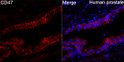 Immunofluorescence analysis of Human prostate tissue using CD47 Rabbit polyclonal antibody (STJ29417) at a dilution of 1:100 (40x lens). Secondary antibody: Cy3-conjugated Goat anti-Rabbit IgG (H+L) at 1:500 dilution. Blue: DAPI for nuclear staining. High pressure antigen retrieval performed with 0. 01M Citrate Buffer (pH 6. 0) prior to IF staining.