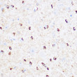 Immunohistochemistry analysis of CD47 in paraffin-embedded Mouse brain using CD47 Rabbit polyclonal antibody (STJ29417) at dilution of 1:100 (40x lens). Perform microwave antigen retrieval with 10 mM Tris/EDTA buffer pH 9. 0 before commencing with immunohistochemistry staining protocol.