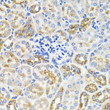 Immunohistochemistry analysis of paraffin-embedded mouse kidney using PRKAG1 antibody (STJ29439) at dilution of 1:100 (40x lens). Perform microwave antigen retrieval with 10 mM PBS buffer pH 7. 2 before commencing with immunohistochemistry staining protocol.