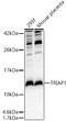 Western blot analysis of various lysates, using TRIAP1 rabbit polyclonal antibody (STJ29452) at 1:3000 dilution. Secondary antibody: HRP Goat Anti-rabbit IgG (H+L) (STJS000856) at 1:10000 dilution. Lysates/proteins: 25 Mu g per lane. Blocking buffer: 3% non-fat dry milk in TBST. Detection: ECL Basic Kit. Exposure time: 90s.