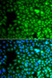 Immunofluorescence analysis of A549 cells using ZNF195 antibody (STJ29486). Blue: DAPI for nuclear staining.