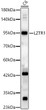 Western blot analysis of lysates from C6 cells, using LZTR1 Rabbit polyclonal antibody (STJ29489) at 1:2000 dilution. Secondary antibody: HRP Goat Anti-Rabbit IgG (H+L) (STJS000856) at 1:10000 dilution. Lysates/proteins: 25ug per lane. Blocking buffer: 3% nonfat dry milk in TBST. Detection: ECL Basic Kit. Exposure time: 60s.