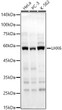Western blot analysis of various lysates, using LHX6 Rabbit polyclonal antibody (STJ29502) at 1:2000 dilution. Secondary antibody: HRP Goat Anti-Rabbit IgG (H+L) (STJS000856) at 1:10000 dilution. Lysates/proteins: 25ug per lane. Blocking buffer: 3% nonfat dry milk in TBST. Detection: ECL Basic Kit. Exposure time: 30s.