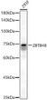 Western blot analysis of 293F, using ZBTB48 antibody (STJ29571) at 1:500 dilution. Secondary antibody: HRP Goat Anti-Rabbit IgG (H+L) (STJS000856) at 1:10000 dilution. Lysates/proteins: 25 Mu g per lane. Blocking buffer: 3% nonfat dry milk in TBST. Detection: ECL Basic Kit. Exposure time: 90s.